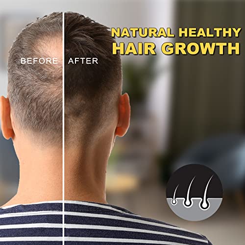 5% Minoxidil for Men and Women Hair Growth Oil  Biotin Serum  Hair Regrowth Treatment for Scalp Hair Loss  Natural  for Thicker Longer Fuller Healthier Hair 2.02 oz